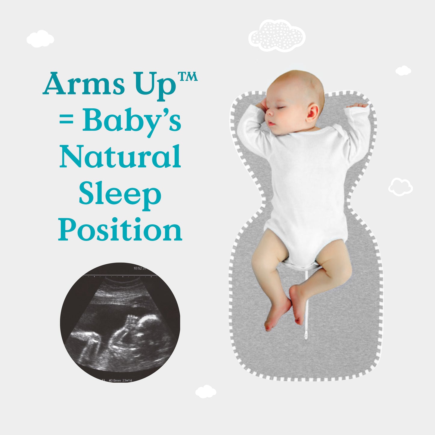 Swaddle Up™ Cotton Original Designer - Bunny